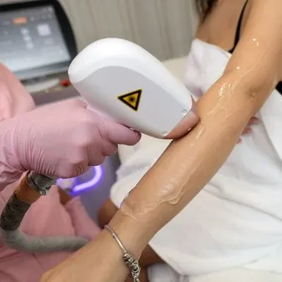 epilare definitiva cu laser Cluj